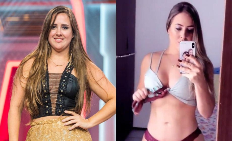 Abdominoplastia Patricia Abdominoplastia Patricia