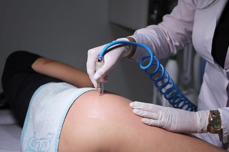 Tratamento para estrias nas pernas procure um profissional especializado Tratamento para estrias procure um profissional especializado