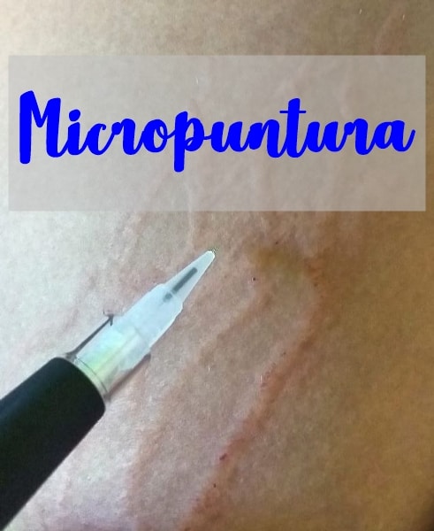 micropuntura